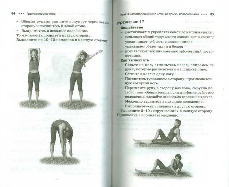 Пять простых способов предотвратить грыжу