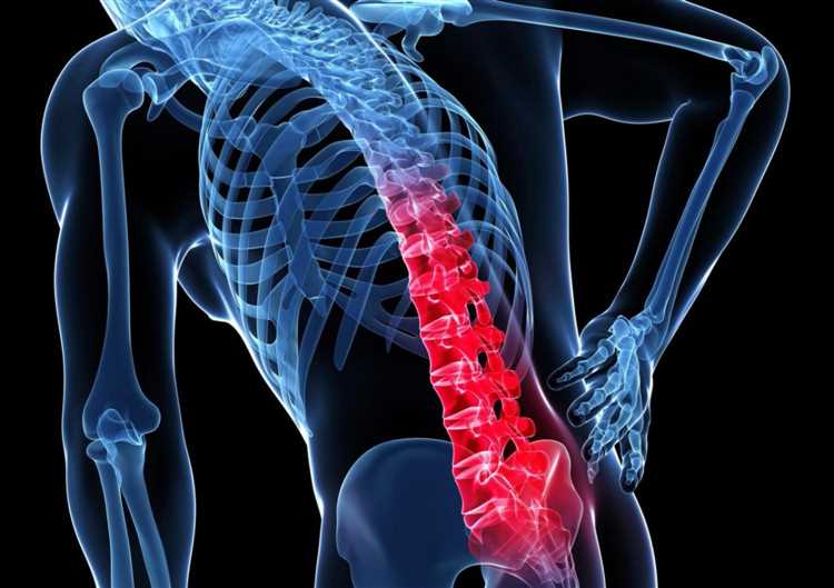 Алтернативные методы лечения грыжи мифы и реальность