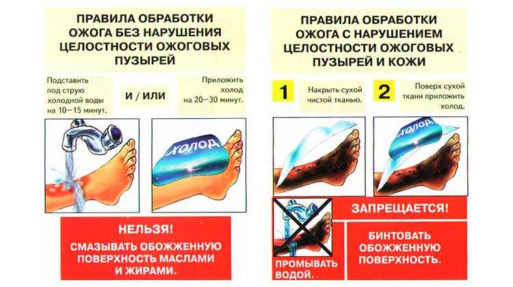 Грыжезащитное белье что это и как оно помогает