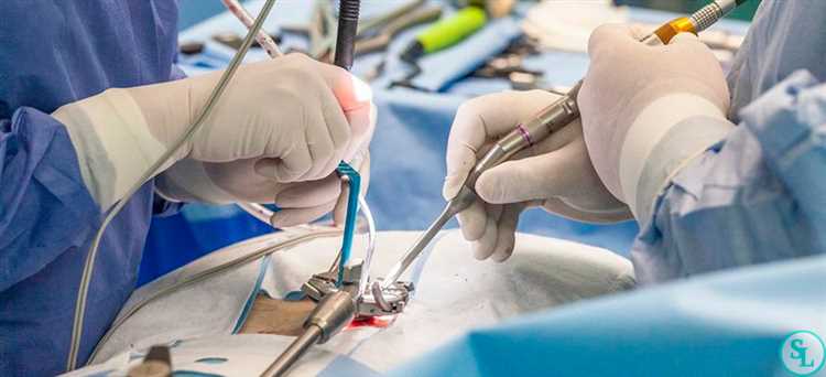 Методы управления симптомами грыжи для эффективного лечения