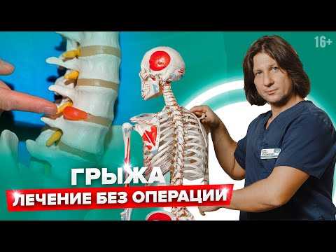 Эффективные советы по лечению грыжи от пациентов