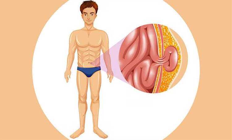 Грыжа и ее предрасполагающие факторы что нужно знать