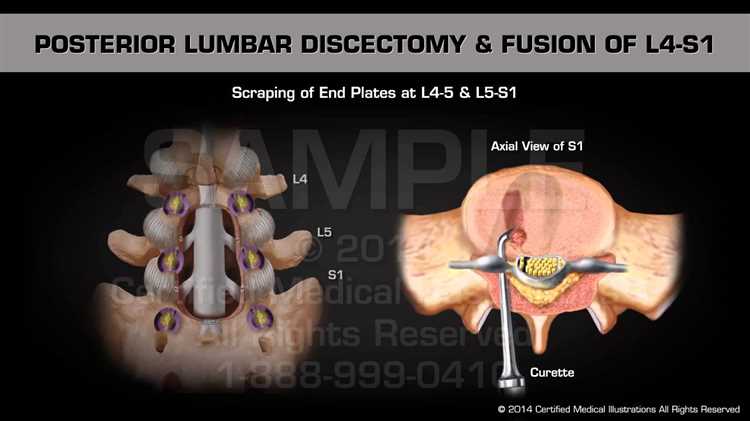 Грыжа и методы её визуализации что нужно знать пациентам