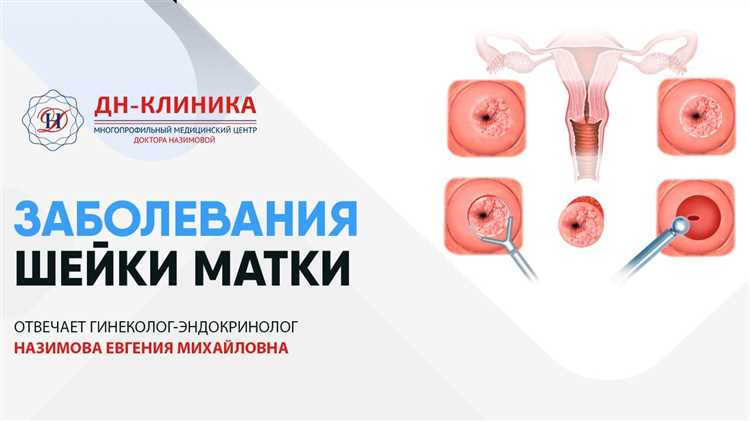 Грыжа и медицинское обследование для точного диагноза