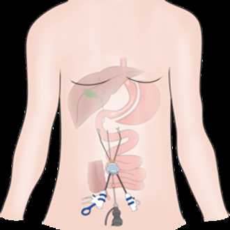 Грыжа и обследование как альтернатива хирургии
