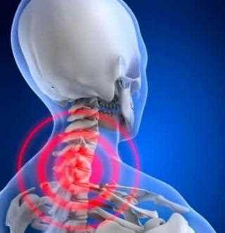 Грыжа шейного отдела симптомы и особенности лечения