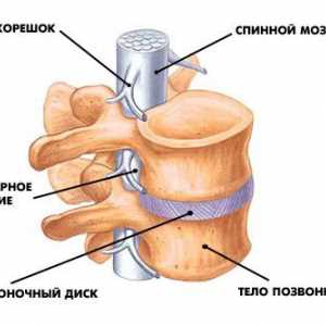 Грыжа мифы и реальность о заболевании