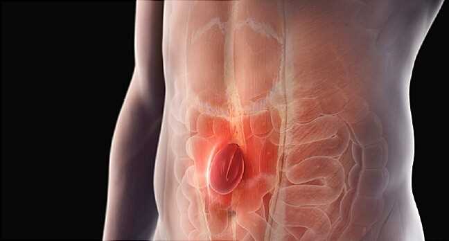Грыжевые кольца их особенности и методы лечения