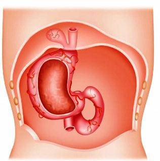 рисунок грыжи