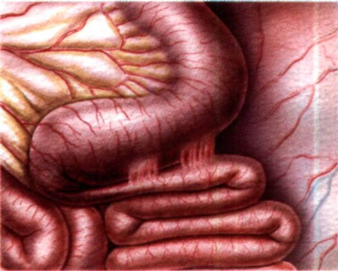 непроходимость кишечника