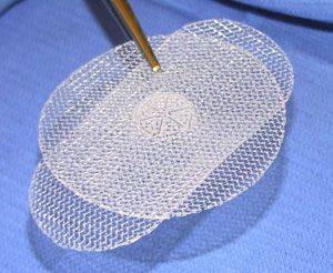 сетчатый имплантант