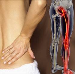 седалищный нерв