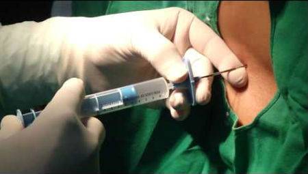 блокада позвоночника