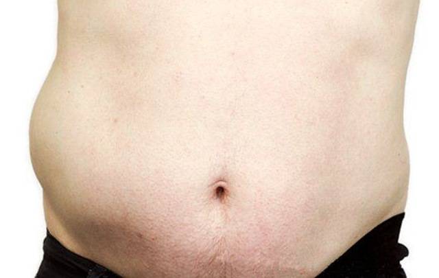 грыжа живота