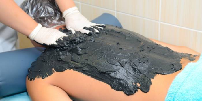 грязелечение