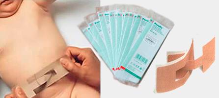 пупочный пластырь