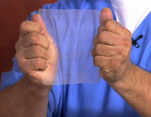 сетка для лечения грыжи