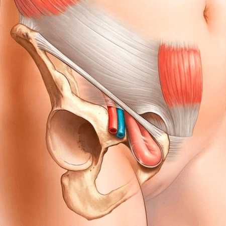Признаки грыжи которые требуют обращения к врачу
