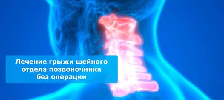 Как выбрать эффективное лечение грыжи по рекомендациям врачей