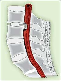 Как Определить Грыжу Симптомы Популярных Типов Грыж