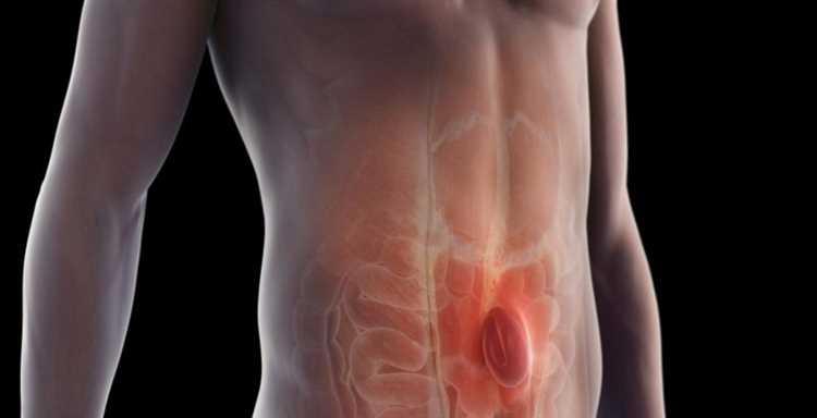 Мой путь к выздоровлению от грыжи советы и личный опыт