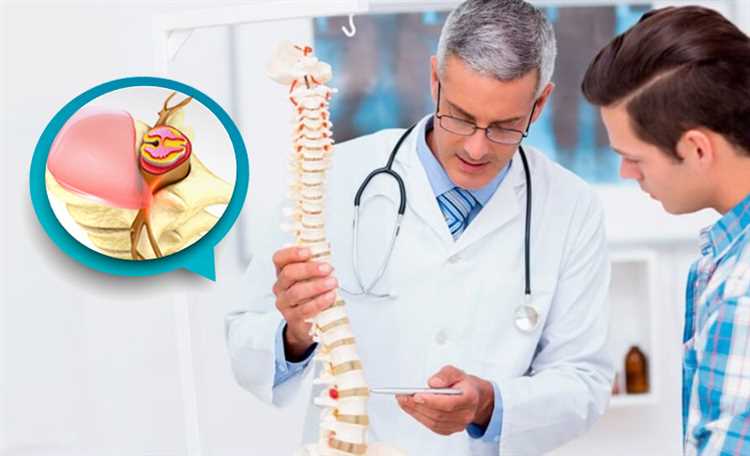 Эффективные методы лечения грыжи на разных стадиях по рекомендациям врачей