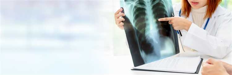 Методы лечения диафрагмальной грыжи консервативные и хирургические