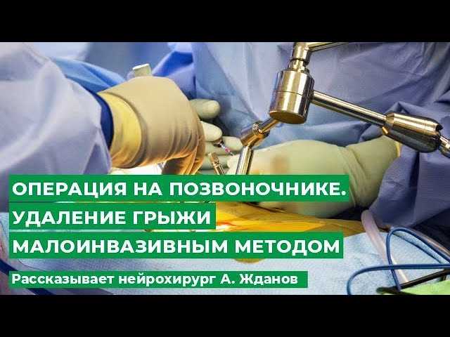 Оперативное лечение грыжи что нужно знать перед операцией