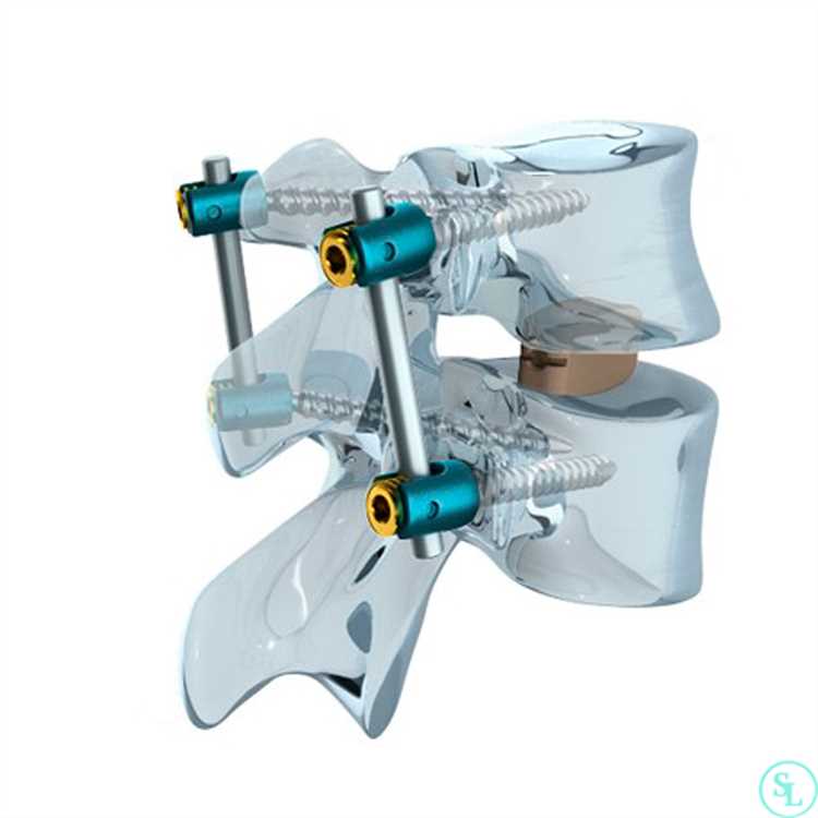 Ошибки хирургов при операции на грыже и уроки из неудачных случаев