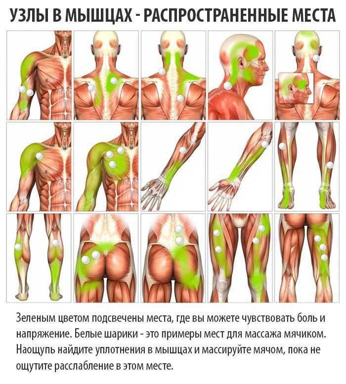 Как стресс может спровоцировать возникновение грыжи