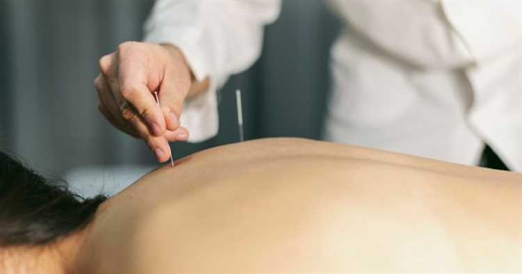 Психотерапия как ключ к облегчению реабилитации после операции на грыже