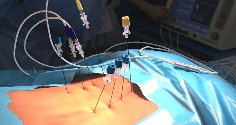 Позитивное мышление как ключевой фактор в лечении грыжи исследуем подходы и рекомендации