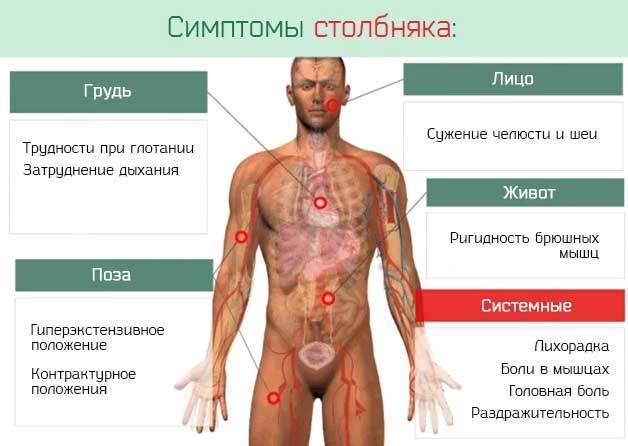 симптомы столбняка
