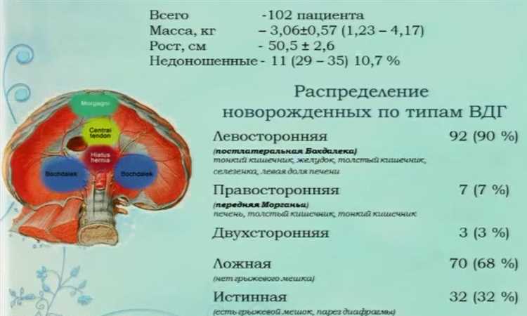 Новейшие технологии в лечении диафрагмальных грыж