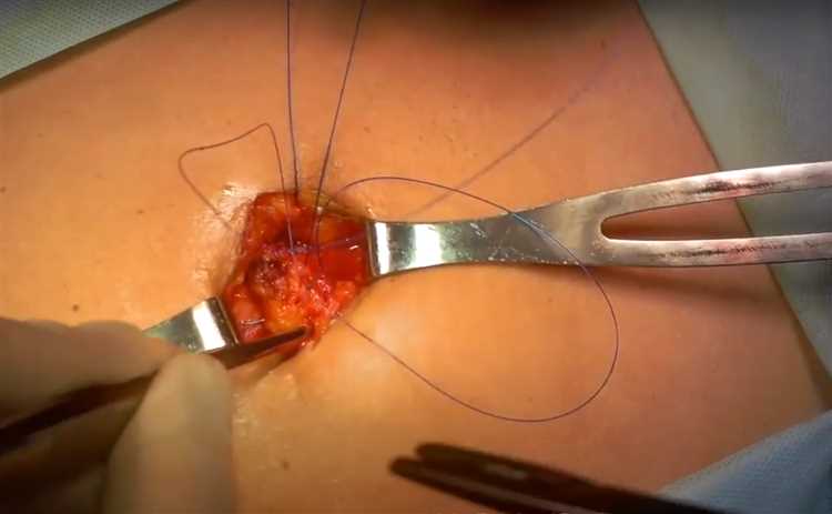 Типы медицинских обследований при грыже что нужно знать