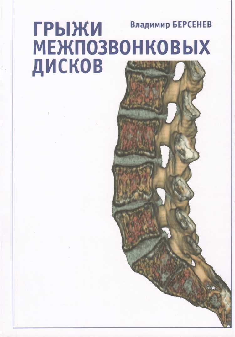 10 захватывающих заголовков для статей о лечении грыжи