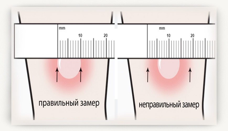 замер манту